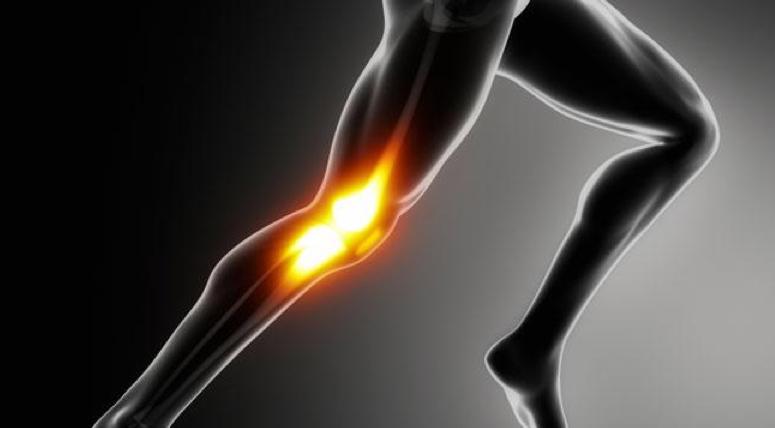 runners knee-image